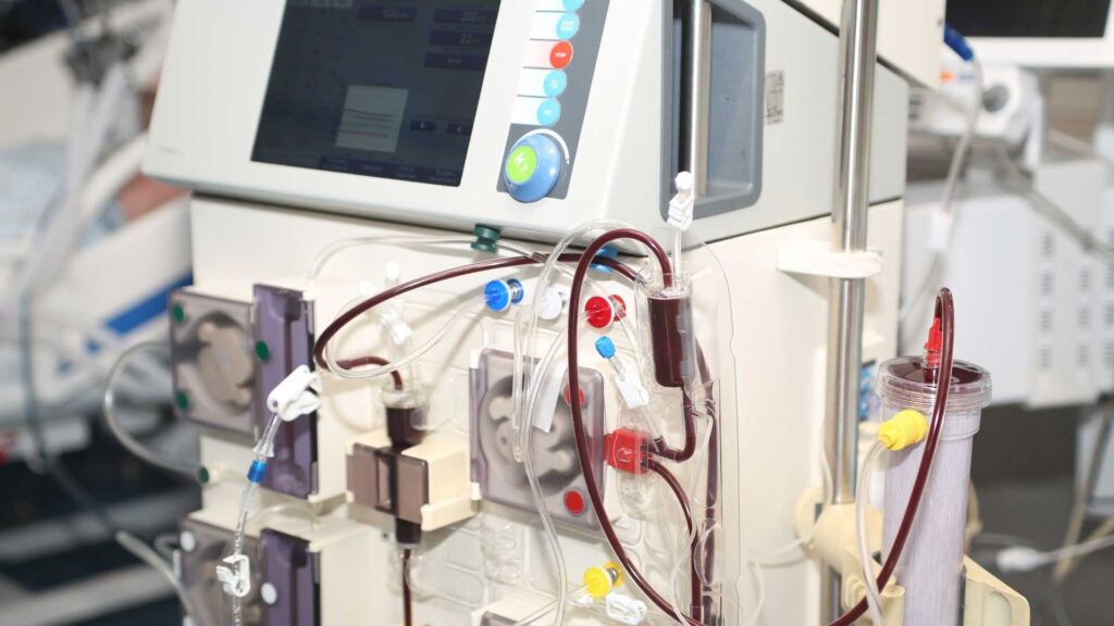 Know Everything About Renal Replacement Therapy In Kolkata