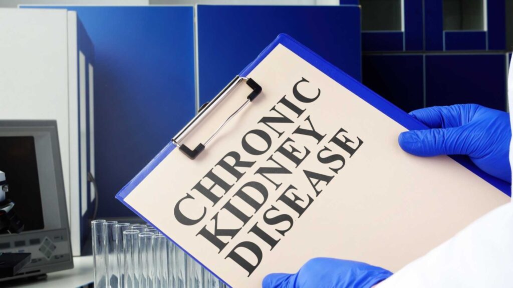 Symptoms Causes And Diagnose of Chronic kidneys disease