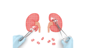 What Are the Signs That You Need Dialysis