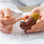 Kidneys transplant